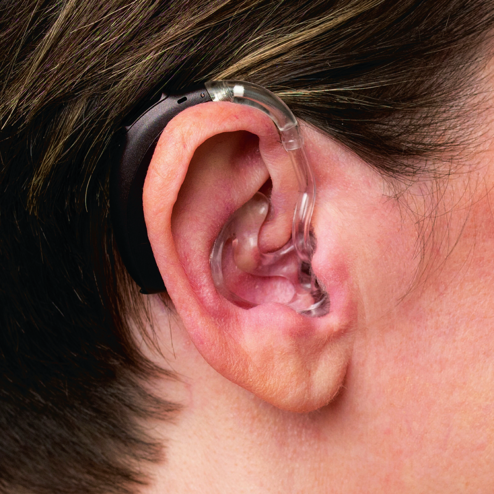 A Phonak Behind-the-Ear hearing aid worn by a patient
