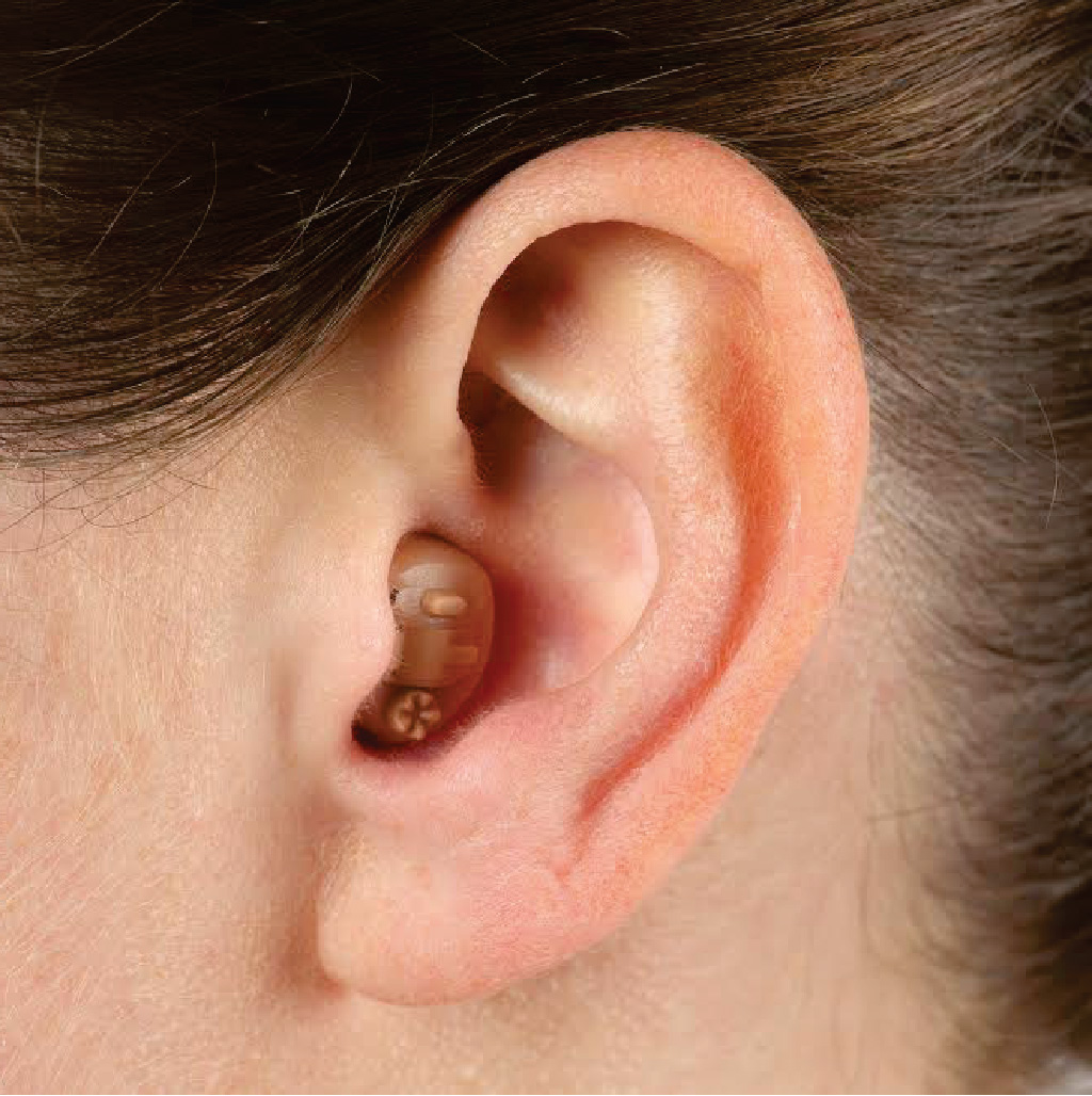 Custom in-the-canal hearing aid — a flesh-toned shell that sits at the canal entry, almost invisible from the front